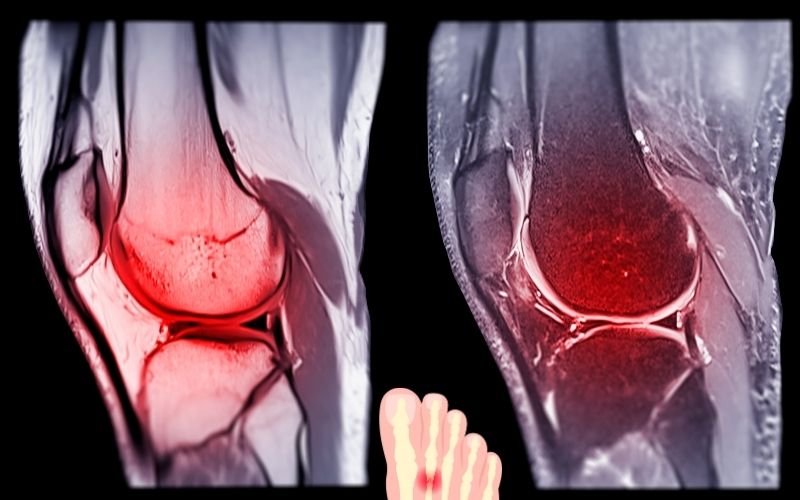 Explore Different Ligament Injuries treatment in delhi In The Body