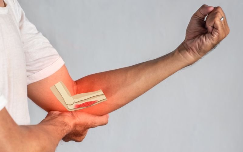 Major Causes of Elbow Pain and How to Reduce Them